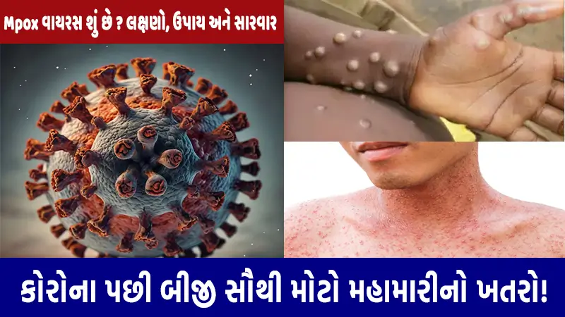 mpox virus details in gujarati